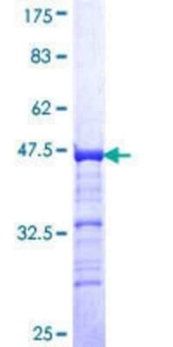 Novus Biologicals Recombinant Human CHmL GST (N-Term) Protein 10 &mu;g | Buy Online | Novus Biologicals&trade; | Fisher Scientific