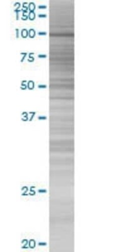 Novus Biologicals CHmL 293T Cell Transient Overexpression Lysate 0.1 mL | Buy Online | Novus Biologicals&trade; | Fisher Scientific
