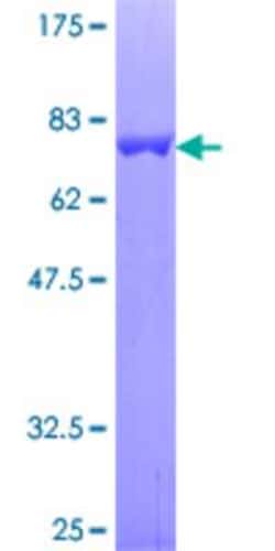 Novus Biologicals&trade;&nbsp;Recombinant Human CHN 1 GST (N-Term) Protein