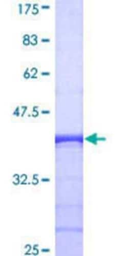 Novus Biologicals Recombinant Human CHN 1 GST (N-Term) Protein 10 &mu;g | Buy Online | Novus Biologicals&trade; | Fisher Scientific