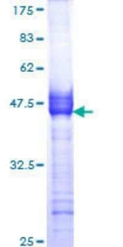 Novus Biologicals Recombinant Human Muscarinic Acetylcholine Receptor M2/CHRM2 GST (N-Term) Protein 10 &mu;g | Buy Online | Novus Biologicals&trade; | Fisher Scientific