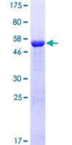 Novus Biologicals Recombinant Human Muscarinic Acetylcholine Receptor M3/CHRM3 GST (N-Term) Protein 25 &mu;g | Buy Online | Novus Biologicals&trade; | Fisher Scientific