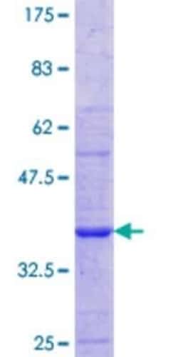 Novus Biologicals Recombinant Human Nicotinic Acetylcholine R alpha 1/CHRNA1 GST (N-Term) Protein 10 &mu;g | Buy Online | Novus Biologicals&trade; | Fisher Scientific