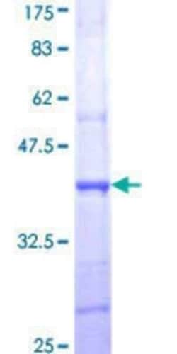 Novus Biologicals Recombinant Human Nicotinic Acetylcholine R alpha 4/CHRNA4 GST (N-Term) Protein 10 &mu;g | Buy Online | Novus Biologicals&trade; | Fisher Scientific