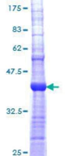 Novus Biologicals Recombinant Human Nicotinic Acetylcholine R alpha 5/CHRNA5 GST (N-Term) Protein 10 &mu;g | Buy Online | Novus Biologicals&trade; | Fisher Scientific