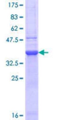 Novus Biologicals Recombinant Human Nicotinic Acetylcholine Receptor beta 2 GST (N-Term) Protein 10 &mu;g | Buy Online | Novus Biologicals&trade; | Fisher Scientific