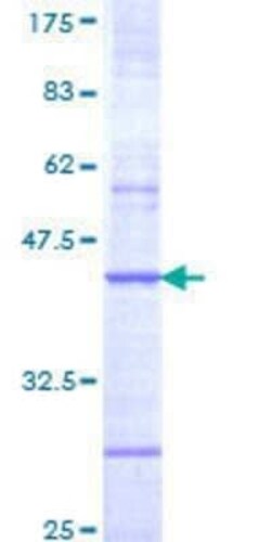 Novus Biologicals Recombinant Human Nicotinic Acetylcholine Receptor beta 4 GST (N-Term) Protein 25 &mu;g | Buy Online | Novus Biologicals&trade; | Fisher Scientific