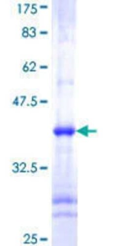 Novus Biologicals&trade;&nbsp;Recombinant Human IKK alpha GST (N-Term) Protein