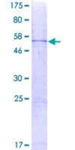 Novus Biologicals Recombinant Human CIDEA GST (N-Term) Protein 2 &mu;g | Buy Online | Novus Biologicals&trade; | Fisher Scientific