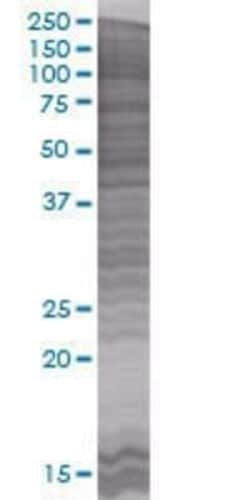 Novus Biologicals CIDEA 293T Cell Transient Overexpression Lysate 0.1 mL | Buy Online | Novus Biologicals&trade; | Fisher Scientific