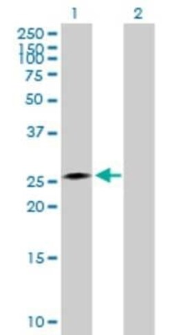 Novus Biologicals CIDEA 293T Cell Transient Overexpression Lysate 0.1 mL | Buy Online | Novus Biologicals&trade; | Fisher Scientific