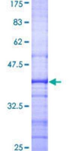 Novus Biologicals Recombinant Human CISH/CIS-1 GST (N-Term) Protein 25 &mu;g | Buy Online | Novus Biologicals&trade; | Fisher Scientific