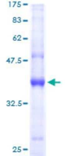 Novus Biologicals Recombinant Human AP2S1 GST (N-Term) Protein 10 &mu;g | Buy Online | Novus Biologicals&trade; | Fisher Scientific