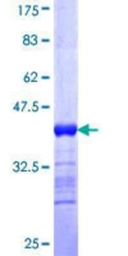 Novus Biologicals Recombinant Human CLCA1 GST (N-Term) Protein 25 &mu;g | Buy Online | Novus Biologicals&trade; | Fisher Scientific