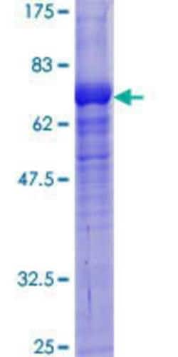 Novus Biologicals&trade;&nbsp;Recombinant Human CLCN2 GST (N-Term) Protein