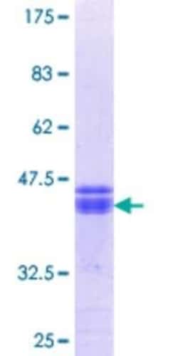 Novus Biologicals Recombinant Human CLCN3 GST (N-Term) Protein 25 &mu;g | Buy Online | Novus Biologicals&trade; | Fisher Scientific