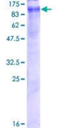 Novus Biologicals Recombinant Human CLCN5 GST (N-Term) Protein 2 &mu;g | Buy Online | Novus Biologicals&trade; | Fisher Scientific