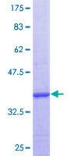 Novus Biologicals Recombinant Human CLCN6 GST (N-Term) Protein 10 &mu;g | Buy Online | Novus Biologicals&trade; | Fisher Scientific