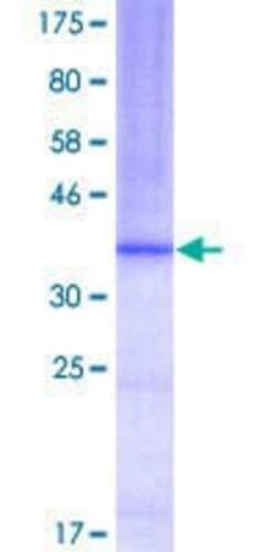 Novus Biologicals Recombinant Human CLCN7 GST (N-Term) Protein 25 &mu;g | Buy Online | Novus Biologicals&trade; | Fisher Scientific