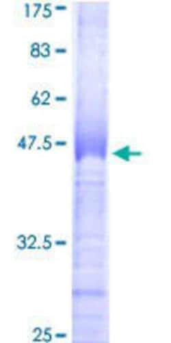 Novus Biologicals Recombinant Human CLK2 GST (N-Term) Protein 10 &mu;g | Buy Online | Novus Biologicals&trade; | Fisher Scientific