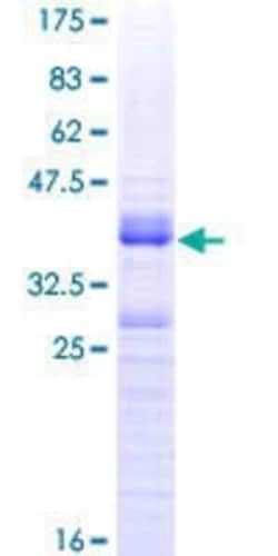 Novus Biologicals Recombinant Human CLK3 GST (N-Term) Protein 10 &mu;g | Buy Online | Novus Biologicals&trade; | Fisher Scientific