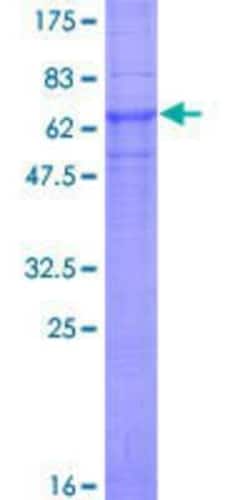 Novus Biologicals™ Recombinant Human CLN3 GST (N-Term) Protein