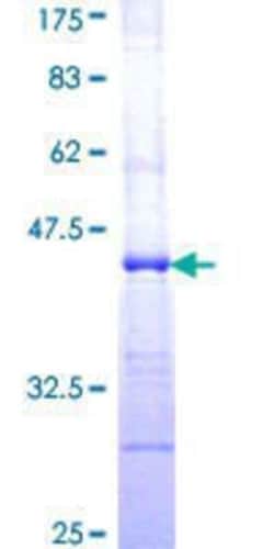 Novus Biologicals Recombinant Human CLPTM1 GST (N-Term) Protein 10 &mu;g | Buy Online | Novus Biologicals&trade; | Fisher Scientific