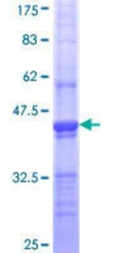 Novus Biologicals&trade;&nbsp;Recombinant Human Clathrin Heavy Chain 1/CHC17 GST (N-Term) Protein
