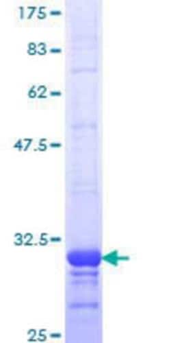 Novus Biologicals&trade;&nbsp;Recombinant Human CCR2 GST (N-Term) Protein