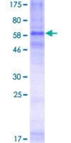 Novus Biologicals Recombinant Human CCR3 GST (N-Term) Protein 2 &mu;g | Buy Online | Novus Biologicals&trade; | Fisher Scientific