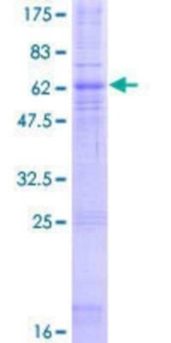 Novus Biologicals Recombinant Human CCR5 GST (N-Term) Protein 2 &mu;g | Buy Online | Novus Biologicals&trade; | Fisher Scientific