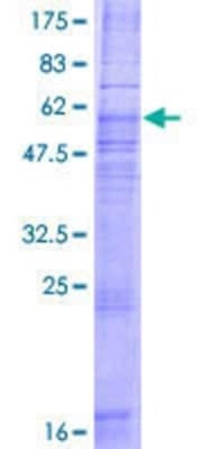 Novus Biologicals Recombinant Human CCR8 GST (N-Term) Protein 2 &mu;g | Buy Online | Novus Biologicals&trade; | Fisher Scientific