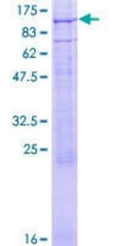 Novus Biologicals Recombinant Human CNGA3 GST (N-Term) Protein 10 &mu;g | Buy Online | Novus Biologicals&trade; | Fisher Scientific