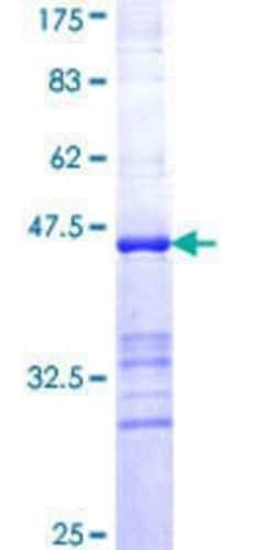 Novus Biologicals Recombinant Human Acidic Calponin GST (N-Term) Protein 25 &mu;g | Buy Online | Novus Biologicals&trade; | Fisher Scientific
