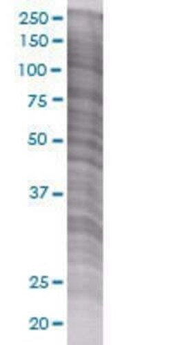 Novus Biologicals Cannabinoid R1/CB1/CNR1 293T Cell Transient Overexpression Lysate 0.1 mL | Buy Online | Novus Biologicals&trade; | Fisher Scientific