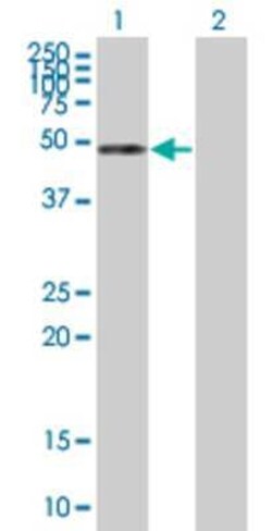 Novus Biologicals Cannabinoid R1/CB1/CNR1 293T Cell Transient Overexpression Lysate 0.1 mL | Buy Online | Novus Biologicals&trade; | Fisher Scientific