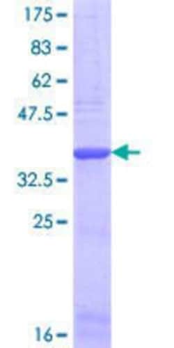 Novus Biologicals&trade;&nbsp;Recombinant Human COL1A2 GST (N-Term) Protein