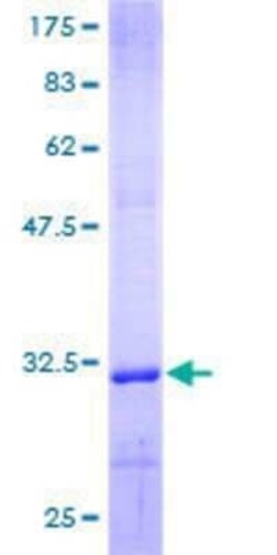 Novus Biologicals Recombinant Human COL4A6 GST (N-Term) Protein 10 &mu;g | Buy Online | Novus Biologicals&trade; | Fisher Scientific