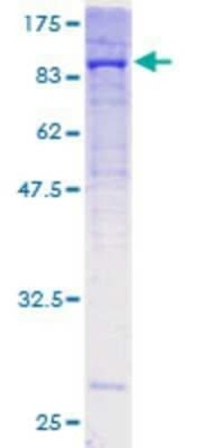 Novus Biologicals Recombinant Human Collagen V GST (N-Term) Protein 10 &mu;g | Buy Online | Novus Biologicals&trade; | Fisher Scientific