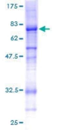 Novus Biologicals Recombinant Human Collagen VI alpha 2 GST (N-Term) Protein 10 &mu;g | Buy Online | Novus Biologicals&trade; | Fisher Scientific