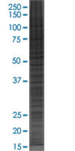 Abnova&trade;&nbsp;COL8A1 293T Cell Transient Overexpression Lysate(Denatured)