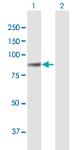 Abnova™ COL8A1 293T Cell Transient Overexpression Lysate(Denatured)