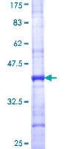 Novus Biologicals Recombinant Human COL9A1 GST (N-Term) Protein 25 &mu;g | Buy Online | Novus Biologicals&trade; | Fisher Scientific