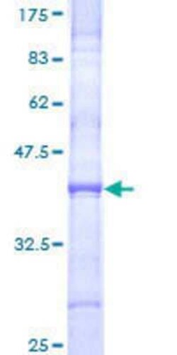 Novus Biologicals&trade;&nbsp;Recombinant Human Collagen XI alpha 2 GST (N-Term) Protein