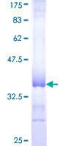 Novus Biologicals Recombinant Human COL16A1 GST (N-Term) Protein 25 &mu;g | Buy Online | Novus Biologicals&trade; | Fisher Scientific
