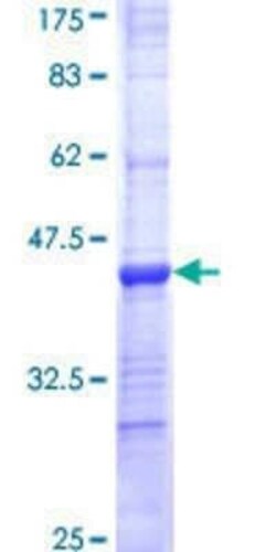 Novus Biologicals Recombinant Human COL19A1 GST (N-Term) Protein 10 &mu;g | Buy Online | Novus Biologicals&trade; | Fisher Scientific