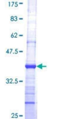 Novus Biologicals Recombinant Human alpha COP I GST (N-Term) Protein 25 &mu;g | Buy Online | Novus Biologicals&trade; | Fisher Scientific