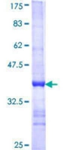 Novus Biologicals Recombinant Human COX4 GST (N-Term) Protein 10 &mu;g | Buy Online | Novus Biologicals&trade; | Fisher Scientific