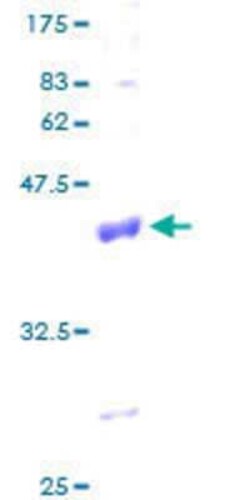 Novus Biologicals Recombinant Human COX6A1 GST (N-Term) Protein 25 &mu;g | Buy Online | Novus Biologicals&trade; | Fisher Scientific