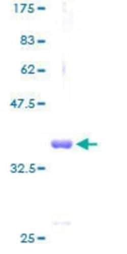 Novus Biologicals Recombinant Human COX6B1 GST (N-Term) Protein 25 &mu;g | Buy Online | Novus Biologicals&trade; | Fisher Scientific